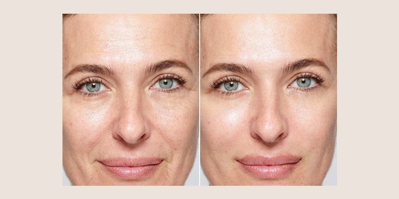 In Article Dry Skin Rules To Follow AgePerfect
